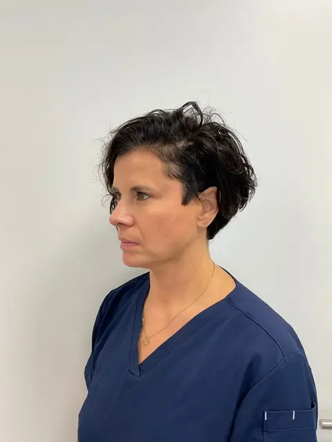 Endolift-voor-zijkant.webp